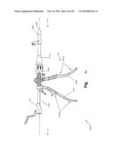 SURGICAL CABLE TENSIONING APPARATUS AND METHOD diagram and image