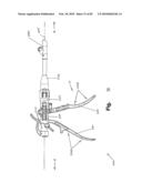 SURGICAL CABLE TENSIONING APPARATUS AND METHOD diagram and image