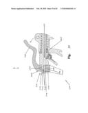 SURGICAL CABLE TENSIONING APPARATUS AND METHOD diagram and image