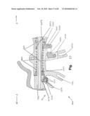 SURGICAL CABLE TENSIONING APPARATUS AND METHOD diagram and image