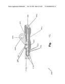 SURGICAL CABLE TENSIONING APPARATUS AND METHOD diagram and image