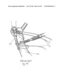 SURGICAL CABLE TENSIONING APPARATUS AND METHOD diagram and image