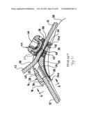 SURGICAL CABLE TENSIONING APPARATUS AND METHOD diagram and image