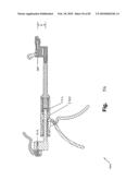 SURGICAL CABLE TENSIONING APPARATUS AND METHOD diagram and image