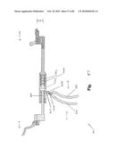 SURGICAL CABLE TENSIONING APPARATUS AND METHOD diagram and image