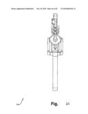 SURGICAL CABLE TENSIONING APPARATUS AND METHOD diagram and image