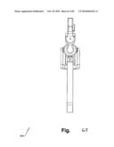 SURGICAL CABLE TENSIONING APPARATUS AND METHOD diagram and image