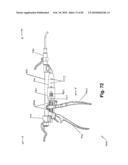 SURGICAL CABLE TENSIONING APPARATUS AND METHOD diagram and image