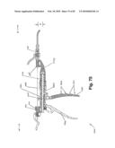 SURGICAL CABLE TENSIONING APPARATUS AND METHOD diagram and image