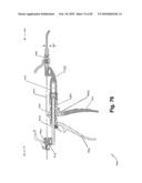 SURGICAL CABLE TENSIONING APPARATUS AND METHOD diagram and image