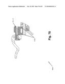 SURGICAL CABLE TENSIONING APPARATUS AND METHOD diagram and image