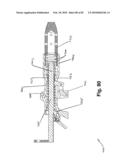 SURGICAL CABLE TENSIONING APPARATUS AND METHOD diagram and image