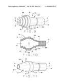 TISSUE RETAINING SYSTEM diagram and image