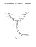 Nostril dilator diagram and image