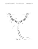 Nostril dilator diagram and image