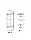 TEMPORARY FILTER DEVICE diagram and image