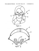 Device for reshaping bones diagram and image