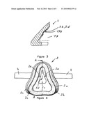 Device for reshaping bones diagram and image