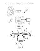 Device for reshaping bones diagram and image