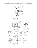 Device for reshaping bones diagram and image