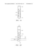 Medical Device for Wound Closure and Method of Use diagram and image