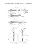 METHOD FOR DELIVERING AN OCCLUSION PLUG diagram and image