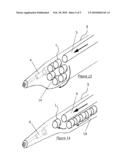 METHOD FOR DELIVERING AN OCCLUSION PLUG diagram and image