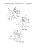 METHOD AND APPARATUS FOR REPAIRING OR REPLACING CHORDAE TENDINAE diagram and image