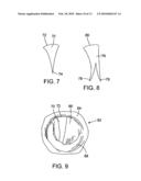 METHOD AND APPARATUS FOR REPAIRING OR REPLACING CHORDAE TENDINAE diagram and image