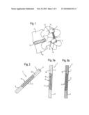 ROD-SHAPED IMPLANT ELEMENT WITH FLEXIBLE SECTION diagram and image