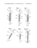 ROD-SHAPED IMPLANT ELEMENT WITH FLEXIBLE SECTION diagram and image