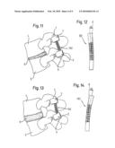 ROD-SHAPED IMPLANT ELEMENT WITH FLEXIBLE SECTION diagram and image