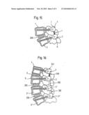 ROD-SHAPED IMPLANT ELEMENT WITH FLEXIBLE SECTION diagram and image