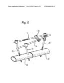 ROD-SHAPED IMPLANT ELEMENT WITH FLEXIBLE SECTION diagram and image