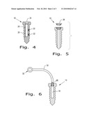 ORTHOPAEDIC SCREWS diagram and image