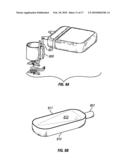 METHOD OF IMPLANTING A MEDICAL IMPLANT TO TREAT HEARING LOSS IN A PATIENT, DEVICES FOR FACILITING IMPLANTATION OF SUCH DEVICES, AND MEDICAL IMPLANTS FOR TREATING HEARING LOSS diagram and image