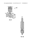 METHOD OF IMPLANTING A MEDICAL IMPLANT TO TREAT HEARING LOSS IN A PATIENT, DEVICES FOR FACILITING IMPLANTATION OF SUCH DEVICES, AND MEDICAL IMPLANTS FOR TREATING HEARING LOSS diagram and image