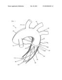 TOTAL AORTIC ARCH RECONSTRUCTION GRAFT diagram and image