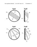 SOFT FILLED PROSTHESIS SHELL WITH DISCRETE FIXATION SURFACES diagram and image