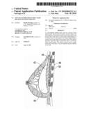 Soft Filled Prosthesis Shell With Discrete Fixation Surfaces diagram and image