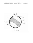 Soft Filled Prosthesis Shell With Discrete Fixation Surfaces diagram and image