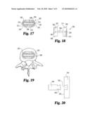 Reinforced molded implant formed of cortical bone diagram and image