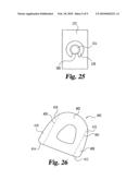 Reinforced molded implant formed of cortical bone diagram and image