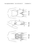 GARMENT diagram and image