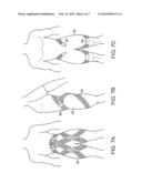 GARMENT diagram and image