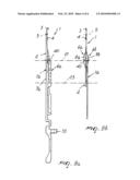 Needle for Transferring Stitches Therefrom to Adjacent Needles for Hosiery Knitting Machines or the Like diagram and image