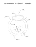  Optimized Key Ring Separator  diagram and image