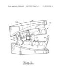 MANDIBULAR ADVANCEMENT DEVICE diagram and image