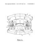 MANDIBULAR ADVANCEMENT DEVICE diagram and image