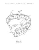 MANDIBULAR ADVANCEMENT DEVICE diagram and image